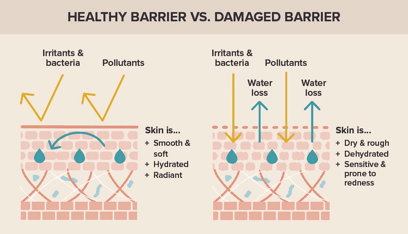 what is qinlan skin barrier repair system 4